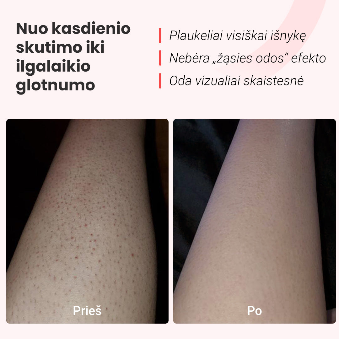 IPL fotoepiliatorius - odoscentras.lt