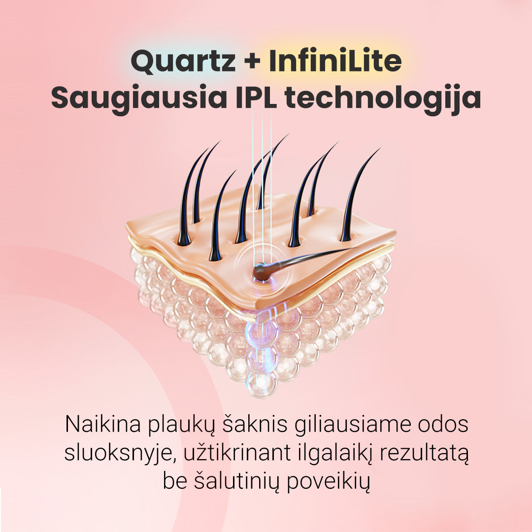 IPL fotoepiliatorius - odoscentras.lt