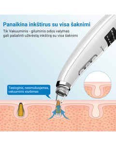 Vakuuminis giluminio odos valymo prietaisas - Odos centras